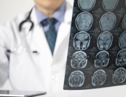 Neurologia